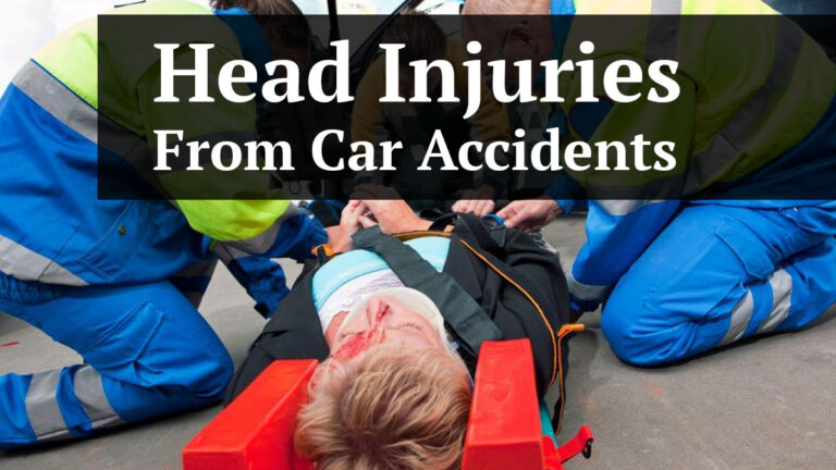 head injuries from car accidents