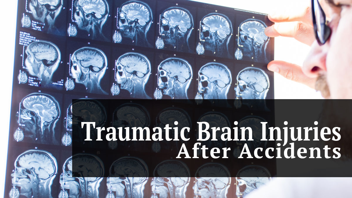 traumatic brain injuries after accidents