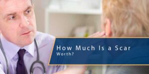 How Much Is a Scar From an Accident Worth?