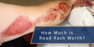 How Much is Road Rash Worth
