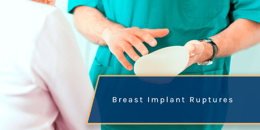 Breast Implant Ruptures After An Auto Accident in 2025