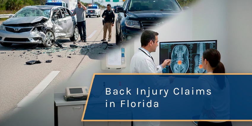 How Much Can You Get for a Back Injury Claim in Florida?